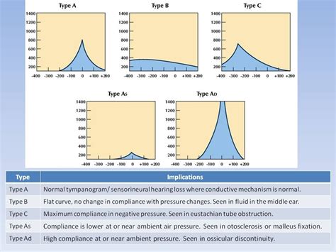 interpreting tympanogram